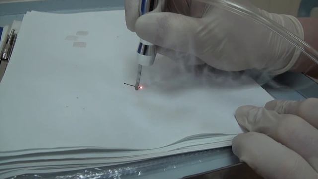 Хирургический СО2 лазер в работе смотреть онлайн