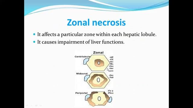 MED Level 2 GIT Liver necrosis 6 4 2021 смотреть онлайн