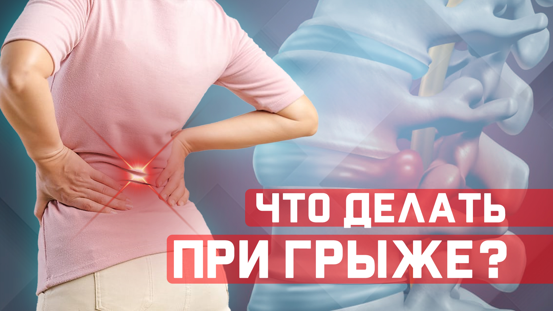 Какие упражнения нужно делать при межпозвонковой грыже? смотреть онлайн