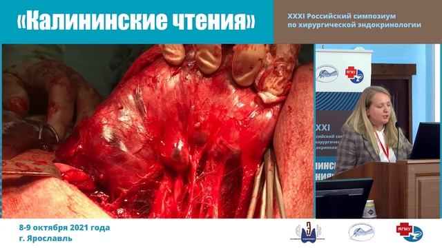 БЕЗОПАСНАЯ ХИРУРГИЯ ЩИТОВИДНОЙ ЖЕЛЕЗЫ смотреть онлайн
