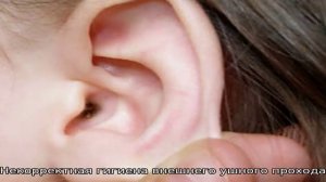 Почему образуются пробки в ушах