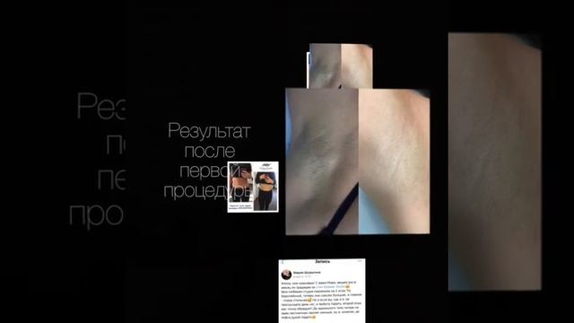 EPILASER STUDIO 2.0 Киров смотреть онлайн