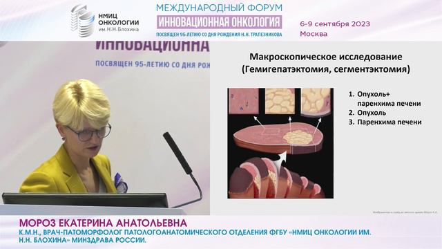 Протокол патоморфологического исследования при ГЦК. Как не пропустить важное?_Мороз Е.А. смотреть онлайн