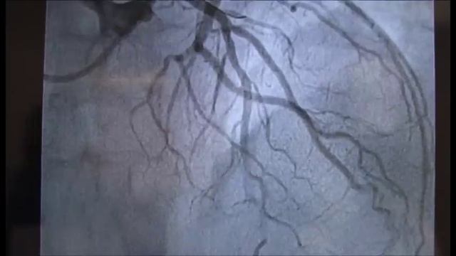 La vanguardia intervencionista del corazón смотреть онлайн