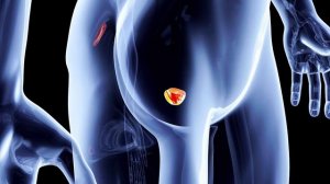 Как быстро определить причину БОЛИ В ЖИВОТЕ? В чем причина болевых ощущений В ЖИВОТЕ?