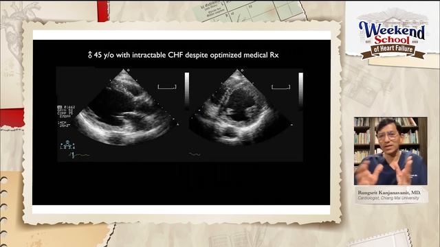 Weekend School of Heart Failure EP 3: All you need to know about the LVEF смотреть онлайн