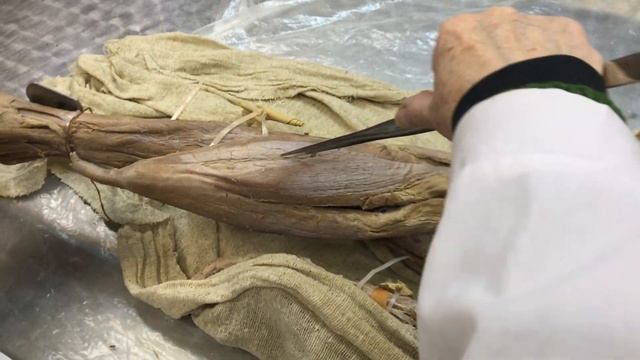 Анатомия. Мышцы нижней конечности (Ч2). смотреть онлайн