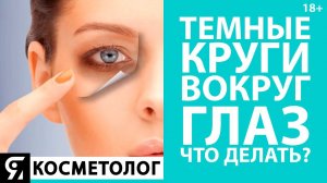 Темные круги вокруг глаз. Что делать? Анастасия Шарова врач косметолог.