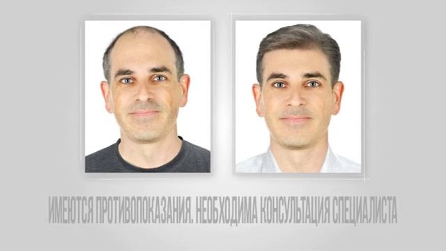 Real Trans Hair - пять причин пересадки волос смотреть онлайн