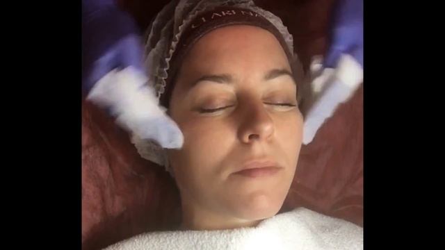 Процедура миндального пилинга Clarena смотреть онлайн