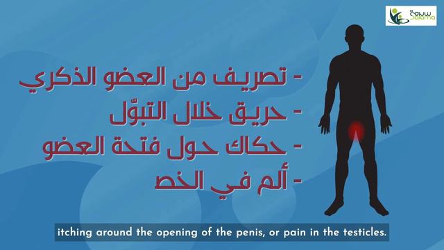 CHLAMYDIA - كلاميديا смотреть онлайн