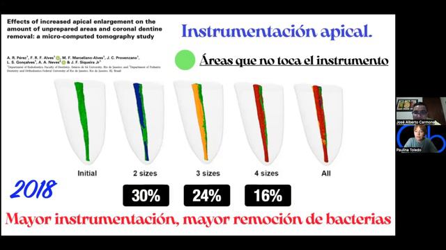 Instrumentación Rotatoria en Endodoncia смотреть онлайн
