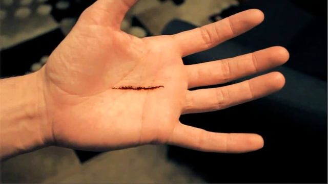 Незаслуженно забытая касторка. смотреть онлайн