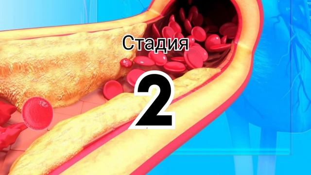 Старые врачи так чистили сосуды головы... смотреть онлайн