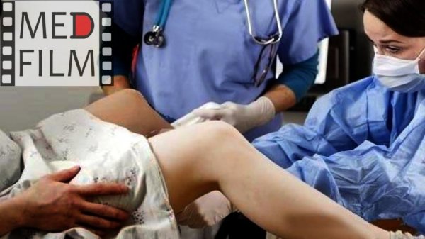 First stage of labor ©