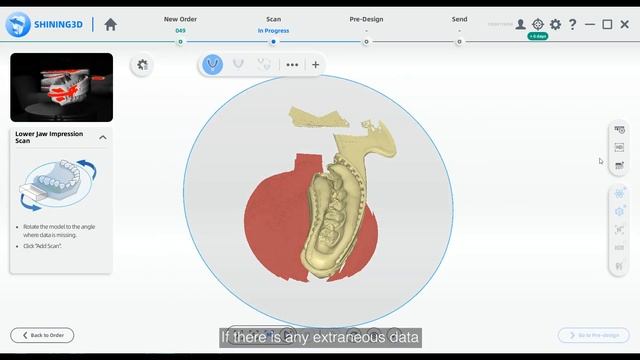 How to Scan a Triple Tray by Dental Lab Scanner смотреть онлайн