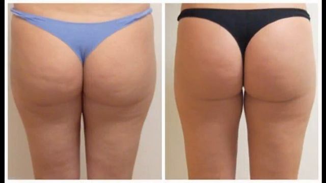 антицеллюлитный крем корректор черный жемчуг смотреть онлайн