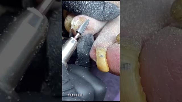 Патология ногтей смотреть онлайн