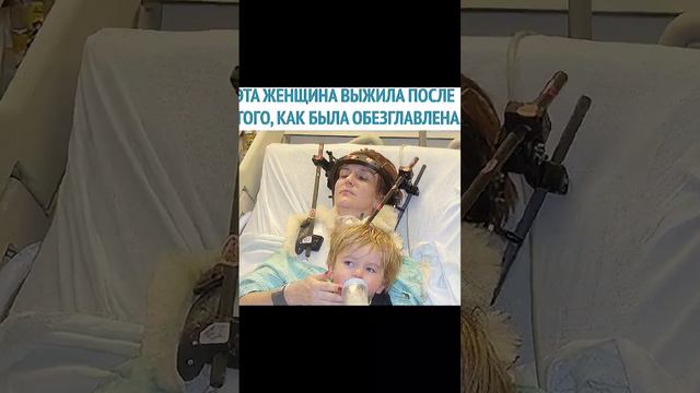 ЖЕНЩИНА ПРОЖИЛА БЕЗ ГОЛОВЫ ЧАС смотреть онлайн