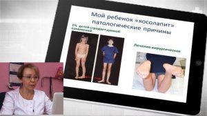 Мой ребенок косолапит!