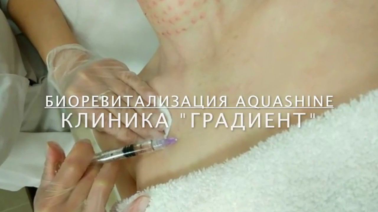Биоревитализация AQUASHINE (Аквашайн) - зона декольте смотреть онлайн