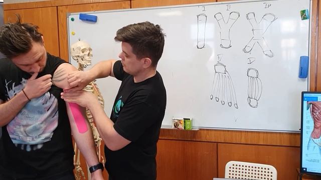 ТЕЙПИРОВАНИЕ БИЦЕПСА