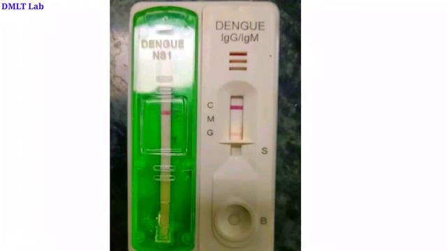 Dengue NS1 || Dengue IGg IgM card смотреть онлайн