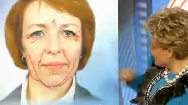 Контурная пластика лица филлерами - уколы красоты смотреть онлайн