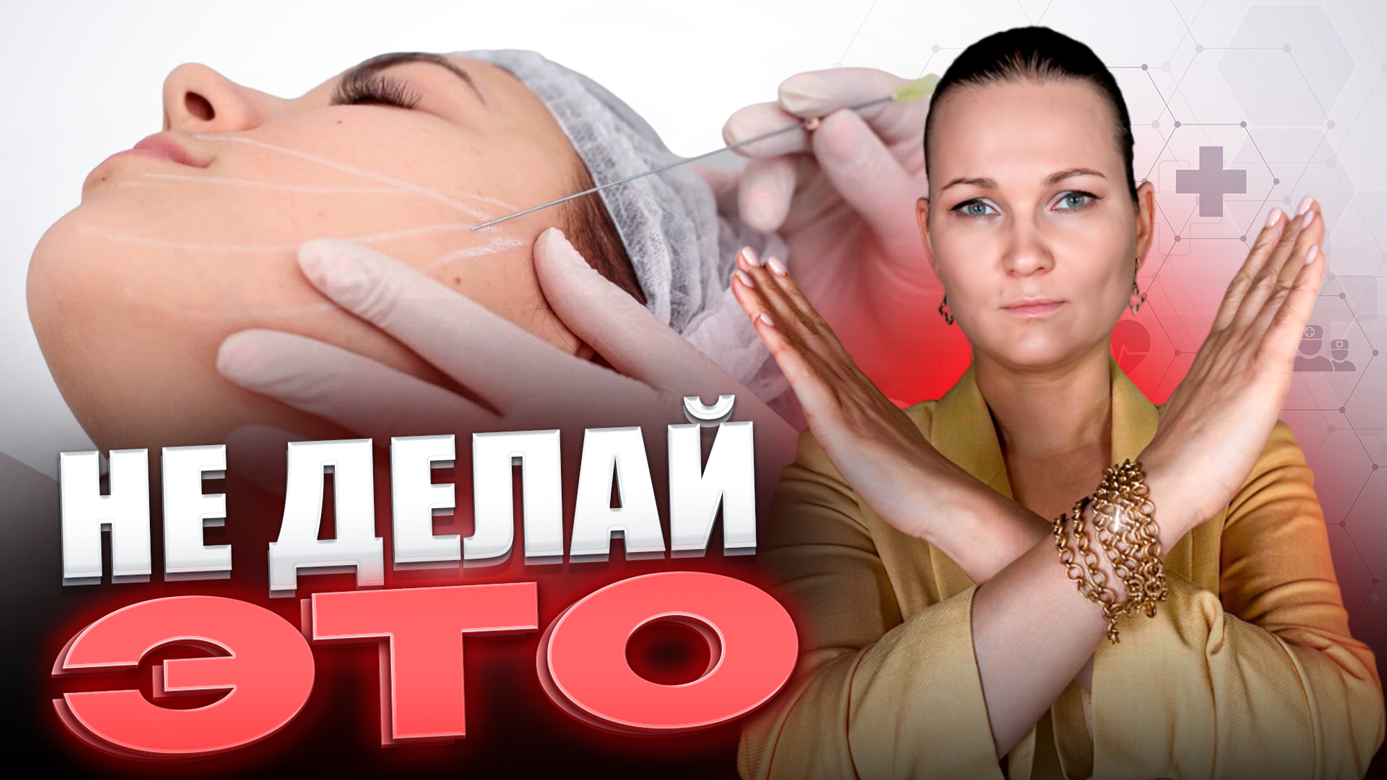 НИТЕВОЙ ЛИФТИНГ ЛИЦА смотреть онлайн