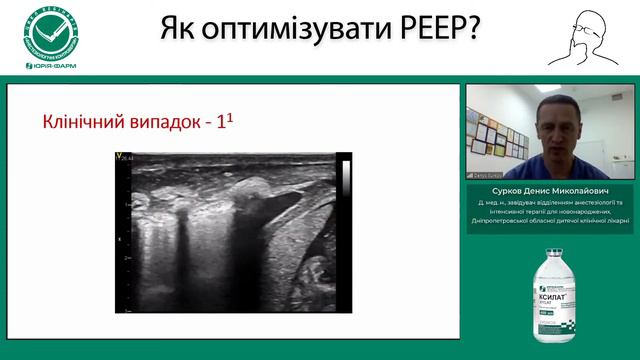 Як оптимізувати PEEP? смотреть онлайн