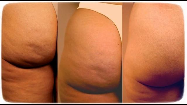 крем антицеллюлитный смотреть онлайн