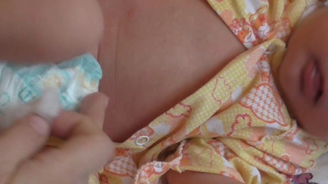 Как лучше всего обрабатывать пупок новорожденного смотреть онлайн