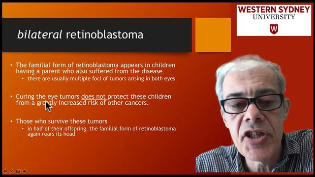 3.3 Retinoblastoma - a rare childhood eye tumor смотреть онлайн
