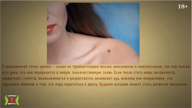 Что случится, если повредить родинку? Что делать, если травмировал родинку? смотреть онлайн