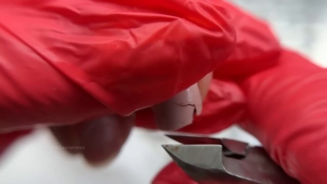 Сломала ноготь что делать? Травма ногтя / Ноготь отошел от пальца / Сломала ноготь под корень