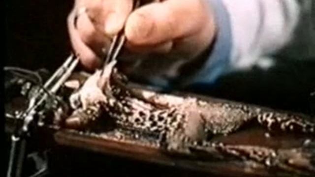 Научфильм. Серия Физиология. Вегетативная Нервная Система смотреть онлайн