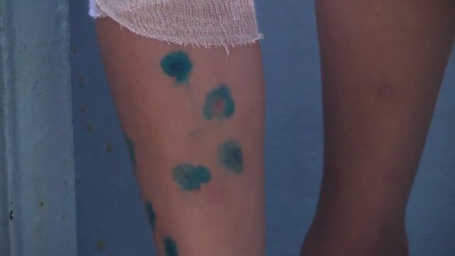 Детей покусали собаки смотреть онлайн