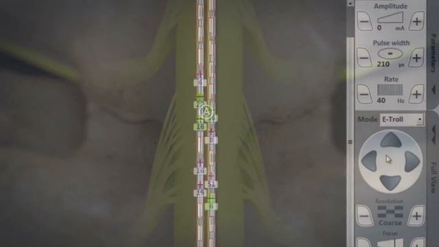 Illumina 3D™ Programming Algorithm смотреть онлайн