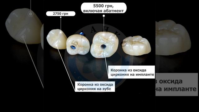 Имплантация зубов Днепр цена | коронка на зуб цена смотреть онлайн