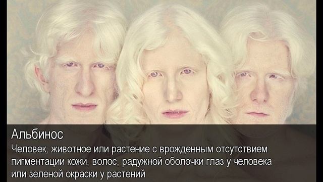Альбинос. Толковый Видеословарь русского языка смотреть онлайн
