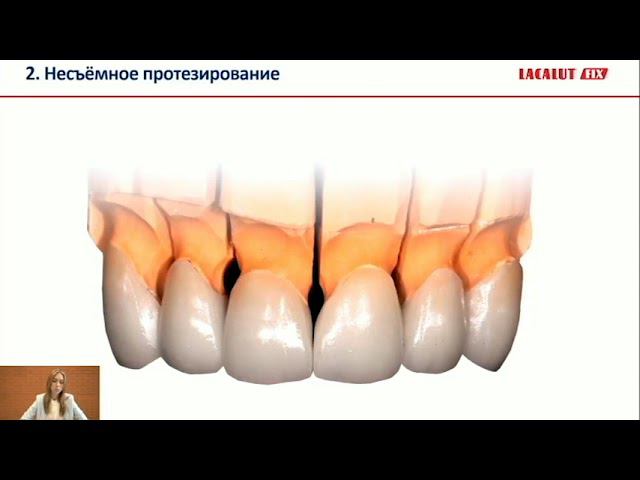 Особенности адаптации пациентов к съемным протезам. Подготовка к съемному протезированию