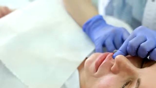 Обучение инъекционному введению препарата Belotero смотреть онлайн