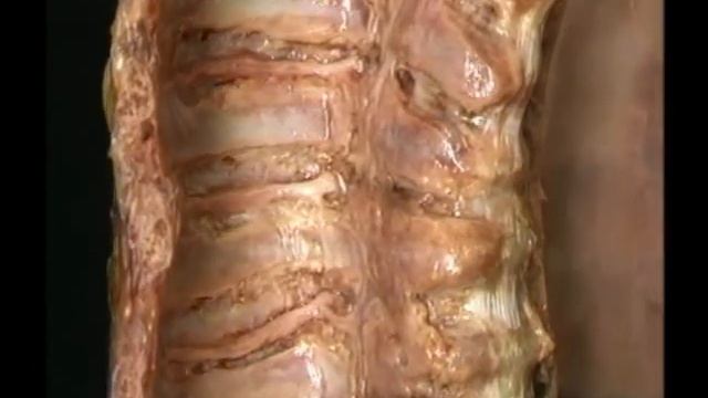 ТУЛОВИЩЕ. | Атлас анатомии Акланда  Фильм 3