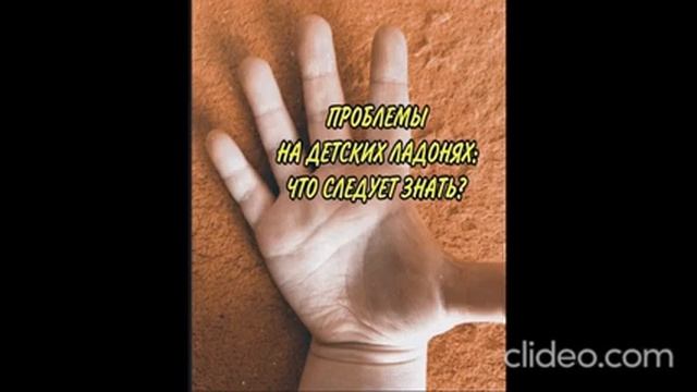 Проблемы на детских ладонях смотреть онлайн