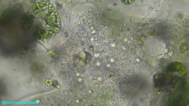 #31 Amoeba sp. смотреть онлайн