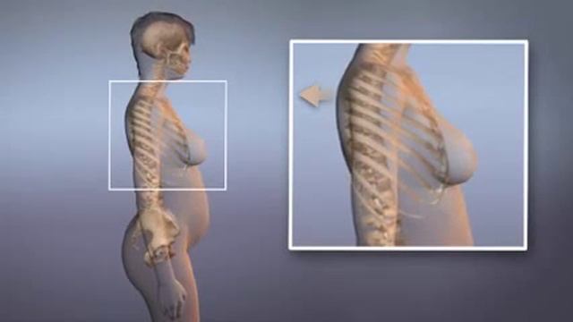 Posture During Pregnancy смотреть онлайн