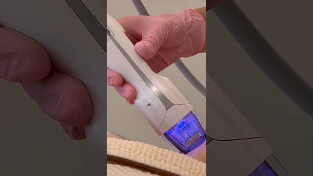 Микроигольчатый рф лифтинг лица на аппарате VIRTUE | сеть клиник косметологии GEN87 смотреть онлайн