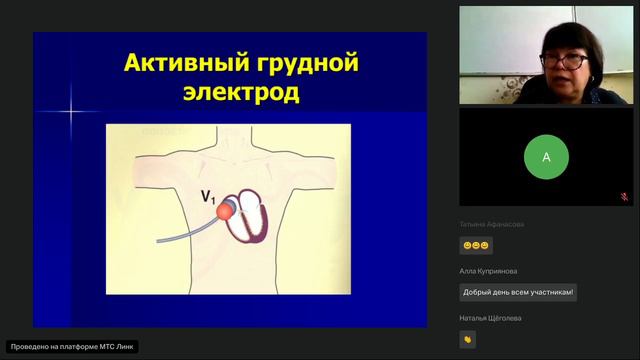 16-04-24 Физико-технические основы ЭКГ. Куприянова АВ смотреть онлайн