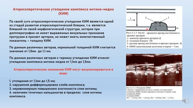 #УЗДГ-Актуальные вопросы практической допплерографии Елизарова Р.А. смотреть онлайн