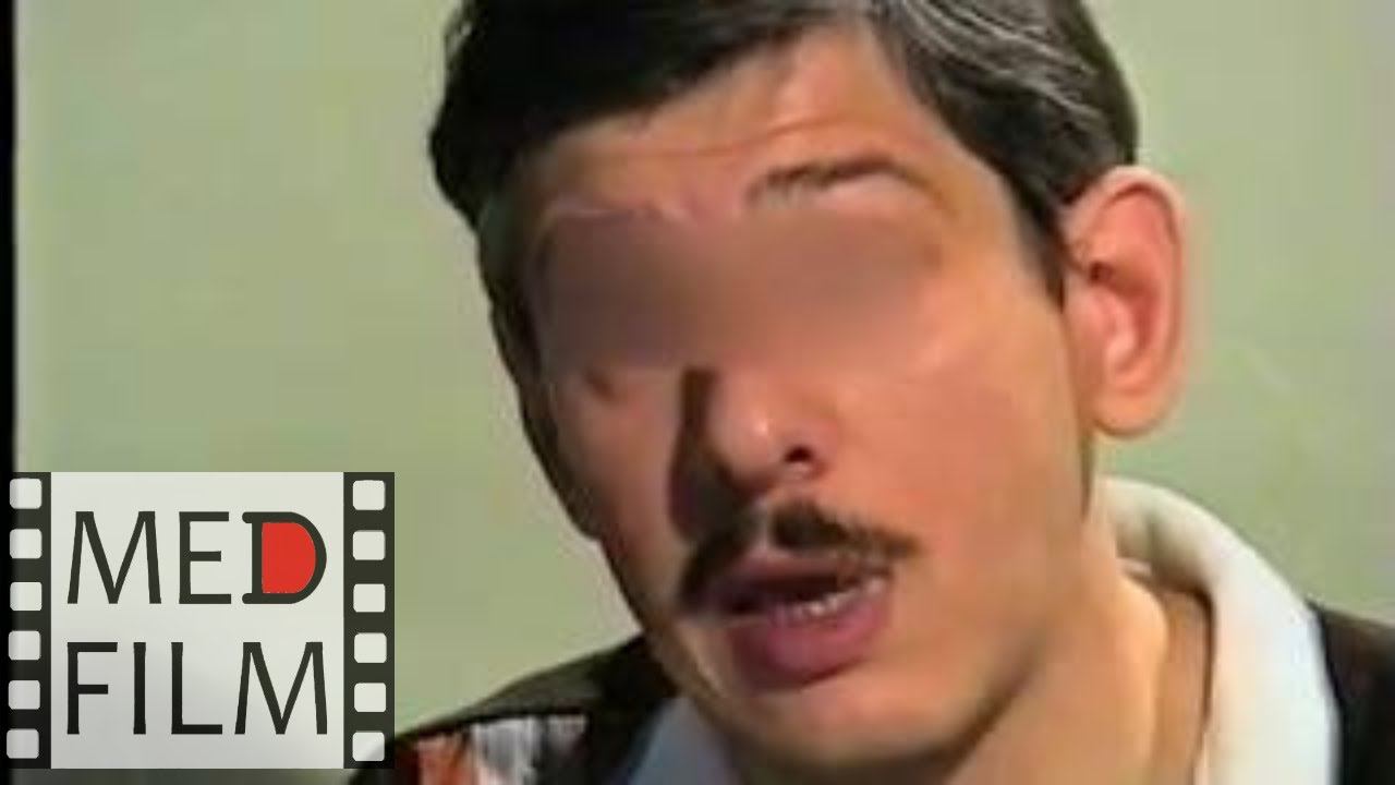 Слабоумие. Поведение в быту. Менингоэнцефалит в детстве © Meningoencephalitis,dementia